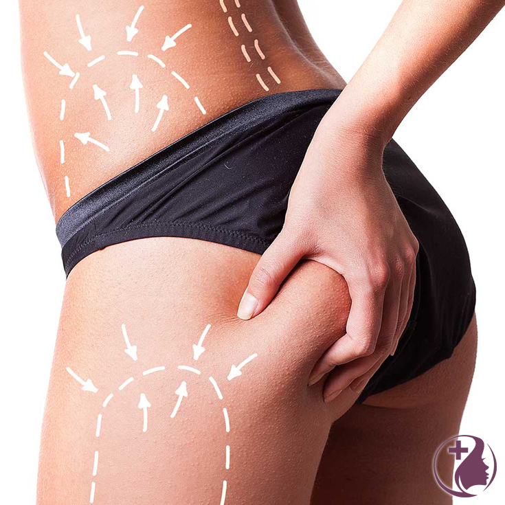 Gross! Cellulite! We all suffer from it and it’s not pretty - but did you know with a little time you can diminish cellulite naturally using essential oils?